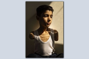 Lo retrach d’un enfant gazauí mutilat ganha lo prèmi World Press Photo 2025