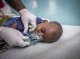 Covid-19: las societats mondialas de l’oxigèn an fixat de prèses excessius pels espitals d’Africa